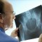 6 Ways to Prevent Osteoporosis getFile